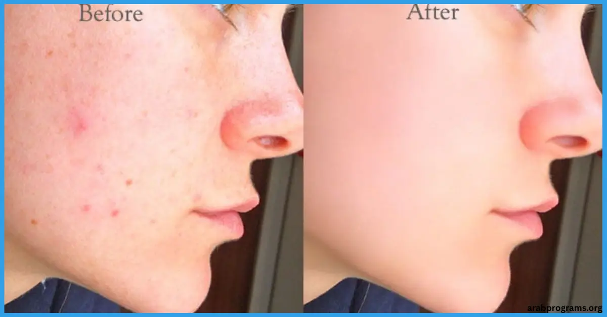 retouch مهكر